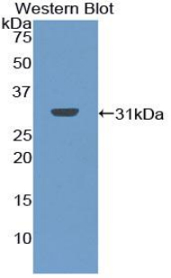 Polyclonal Antibody to Chymotrypsin C (CTRC)