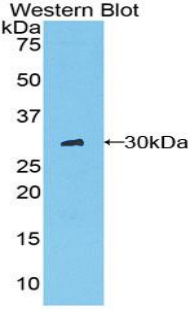 Polyclonal Antibody to Chymotrypsin C (CTRC)