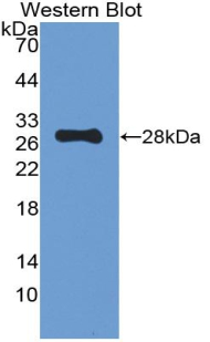 Polyclonal Antibody to Proopiomelanocortin (POMC)