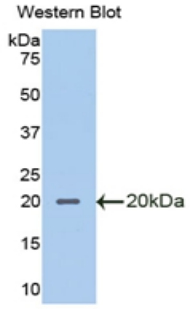 Polyclonal Antibody to Secretory Leukocyte Peptidase Inhibitor (SLPI)