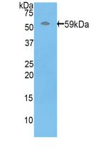 Polyclonal Antibody to Perforin 1 (PRF1)