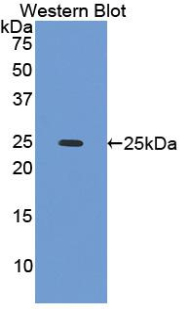 Polyclonal Antibody to Caldesmon (CALD)