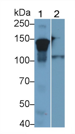 Polyclonal Antibody to Neurofilament 3 (NEF3)