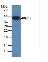 Polyclonal Antibody to Growth Associated Protein 43 (GAP43)