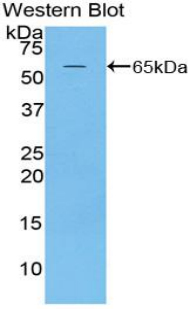 Polyclonal Antibody to Microtubule Associated Protein 2 (MAP2)