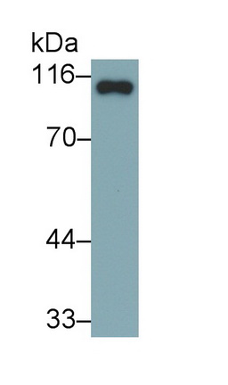 Polyclonal Antibody to Involucrin (INV)