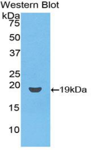 Polyclonal Antibody to Cluster of Differentiation 59 (CD59)