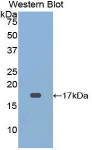 Polyclonal Antibody to Cluster of Differentiation 59 (CD59)