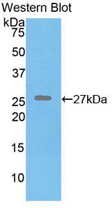 Polyclonal Antibody to Elastin (ELN)