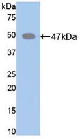 Polyclonal Antibody to Elastin (ELN)