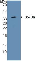 Polyclonal Antibody to Activating Transcription Factor 1 (ATF1)