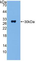 Polyclonal Antibody to Adenylate Cyclase 1, Brain (ADCY1)