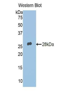 Polyclonal Antibody to Adipose Differentiation Related Protein (ADRP)