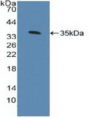 Polyclonal Antibody to Aryl Hydrocarbon Receptor (AhR)