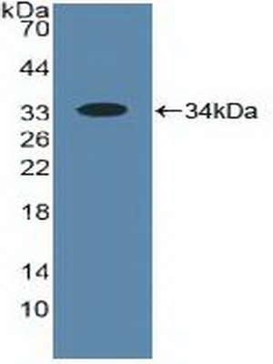 Polyclonal Antibody to 5-Lipoxygenase (5-LO)