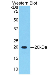 Polyclonal Antibody to 5-Lipoxygenase (5-LO)