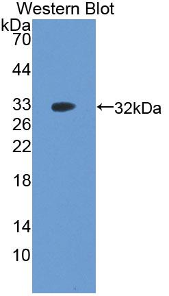 Polyclonal Antibody to Apoptosis Signal Regulating Kinase 1 (ASK1)