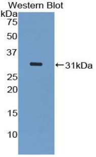 Polyclonal Antibody to Apoptosis Signal Regulating Kinase 1 (ASK1)