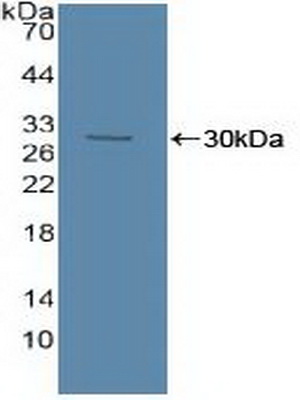 Polyclonal Antibody to Acid Sphingomyelinase (ASM)