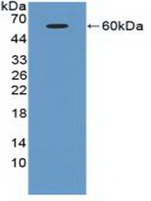 Polyclonal Antibody to Ataxia Telangiectasia Mutated (ATM)