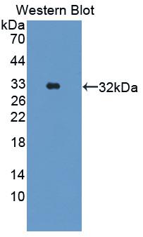 Polyclonal Antibody to Ataxia Telangiectasia Mutated (ATM)