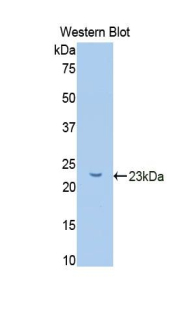 Polyclonal Antibody to Glucokinase Regulatory Protein (GKRP)