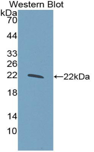 Polyclonal Antibody to Glucokinase Regulatory Protein (GKRP)