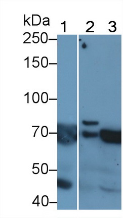 Polyclonal Antibody to Vascular Endothelial Growth Factor Receptor 2 (VEGFR2)