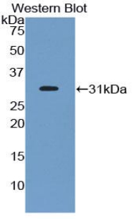 Polyclonal Antibody to Ephrin Type A Receptor 1 (EPHA1)