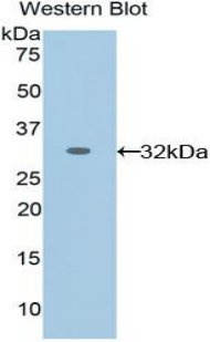 Polyclonal Antibody to Ephrin Type A Receptor 1 (EPHA1)