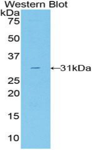 Polyclonal Antibody to Transaldolase (TALDO1)