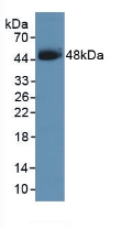 Polyclonal Antibody to Serpin B3 (SERPINB3)