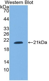 Polyclonal Antibody to Small Nuclear Ribonucleoprotein Polypeptide C (SNRPC)