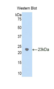 PAB375Hu01.jpg