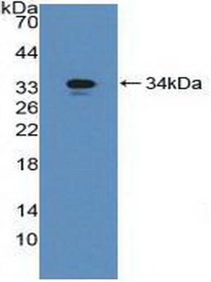 Polyclonal Antibody to Gamma-Glutamyltransferase 1 (gGT1)