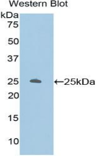 Polyclonal Antibody to Protein Kinase C Zeta (PKCz)