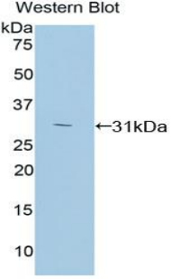 Polyclonal Antibody to Protein Kinase C Zeta (PKCz)