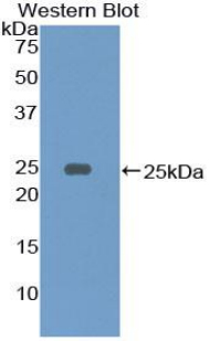 Polyclonal Antibody to Immunoglobulin Associated Alpha (Iga)