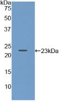 Polyclonal Antibody to Immunoglobulin Associated Alpha (Iga)