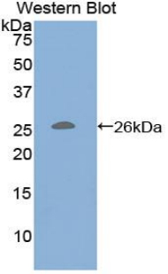 Polyclonal Antibody to Cluster of Differentiation 79B (CD79B)