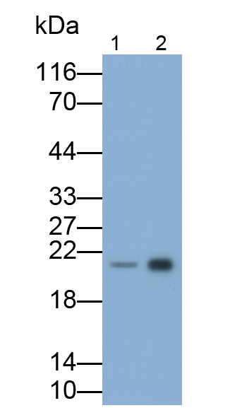 Polyclonal Antibody to Neutrophil gelatinase-associated lipocalin (NGAL)