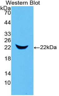 Polyclonal Antibody to Neutrophil gelatinase-associated lipocalin (NGAL)