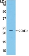 Polyclonal Antibody to Neutrophil gelatinase-associated lipocalin (NGAL)