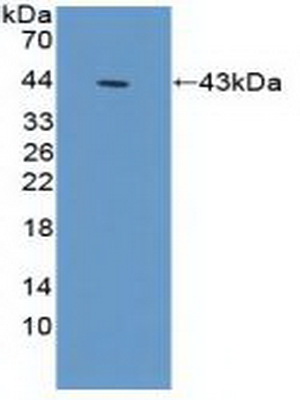 Polyclonal Antibody to Gamma Actin (ACTG)