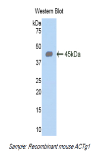 Polyclonal Antibody to Gamma Actin (ACTG)