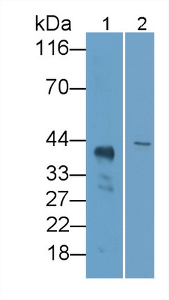 Polyclonal Antibody to Leukocyte Immunoglobulin Like Receptor Subfamily B, Member 4 (LILRB4)