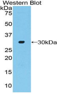 Polyclonal Antibody to Adenylate Cyclase 2, Brain (ADCY2)