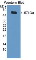 Polyclonal Antibody to Lipopolysaccharide Binding Protein (LBP)