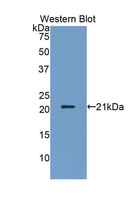 Polyclonal Antibody to Killer Cell Lectin Like Receptor Subfamily D, Member 1 (KLRD1)