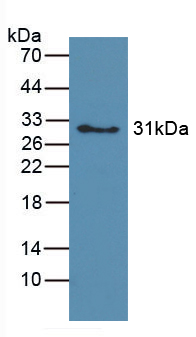 Polyclonal Antibody to Hemoglobin (HB)